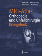 Mrt-Atlas Orthopdie Und Unfallchirurgie: Kniegelenk