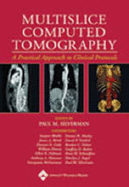 Multislice Computed Tomography: a Practical Approach to Clinical Protools - Silverman, Paul M.