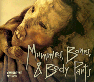 Mummies, Bones, and Body Parts