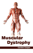 Muscular Dystrophy