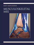 Musculoskeletal MRI: A Rapid Reference Guide