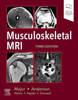 Musculoskeletal MRI - Major, Nancy M., and Anderson, Mark W.
