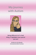 My journey with autism: Being different isn't a bad thing, it highlights how special you are