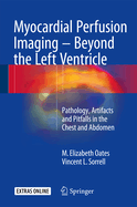 Myocardial Perfusion Imaging - Beyond the Left Ventricle: Pathology, Artifacts and Pitfalls in the Chest and Abdomen