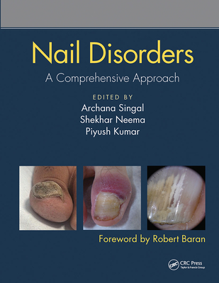 Nail Disorders: A Comprehensive Approach - Singal, Archana (Editor), and Neema, Shekhar (Editor), and Kumar, Piyush (Editor)