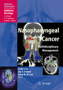 Nasopharyngeal Cancer: Multidisciplinary Management