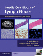 Needle Core Biopsy of Lymph Nodes with DVD-ROM: An Atlas of Hematopathological Disease