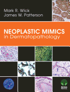 Neoplastic Mimics in Dermatopathology