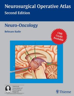 Neuro-Oncology - Badie, Behnam (Editor)