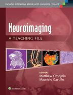 Neuroimaging: A Teaching File: A Teaching File