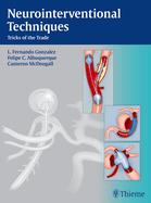 Neurointerventional Techniques: Tricks of the Trade