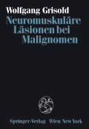 Neuromuskulare Lasionen Bei Malignomen