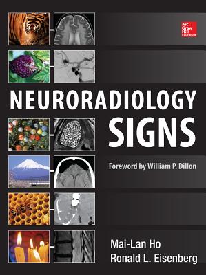 Neuroradiology Signs - Ho, Mai-Lan, and Eisenberg, Ronald