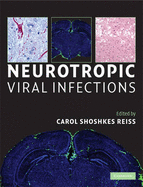 Neurotropic Viral Infections