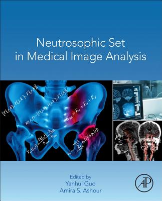 Neutrosophic Set in Medical Image Analysis - Guo, Yanhui (Editor), and Ashour, Amira S. (Editor)