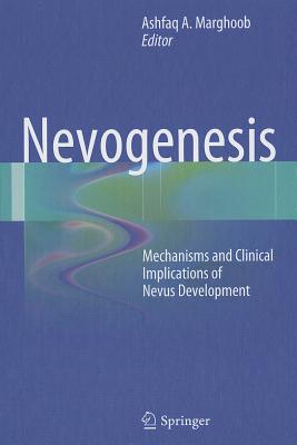 Nevogenesis: Mechanisms and Clinical Implications of Nevus Development - Marghoob, Ashfaq A. (Editor)