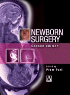 Newborn surgery