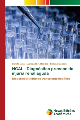 NGAL - Diagn?stico Precoce Da Inj·ria Renal Aguda By Camila Lima ...