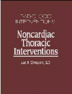 Non-cardiac thoracic interventions - Matsumoto, Alan H.