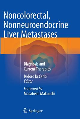 Noncolorectal, Nonneuroendocrine Liver Metastases: Diagnosis and Current Therapies - Di Carlo, Isidoro (Editor)