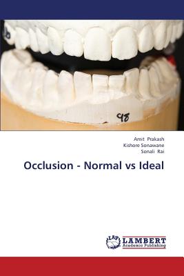 Occlusion - Normal Vs Ideal - Prakash Amit, and Sonawane Kishore, and Rai Sonali