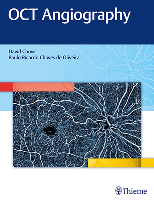 Oct Angiography - Chow, David