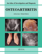 Oesteoarthritis: An Atlas of Investigation and Diagnosis