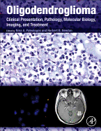 Oligodendroglioma: Clinical Presentation, Pathology, Molecular Biology, Imaging, and Treatment
