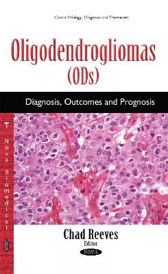 Oligodendrogliomas (ODs): Diagnosis, Outcomes & Prognosis - Reeves, Chad (Editor)