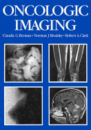 Oncologic Imaging: A Clinical Perspective - Berman, Claudia G, and Brady, Norman J, and Clark, Robert A