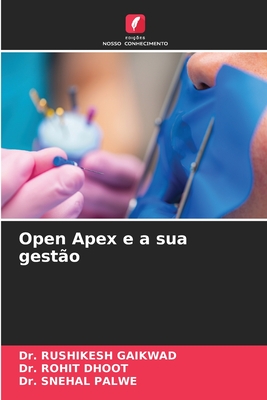 Open Apex e a sua gest?o - Gaikwad, Rushikesh, Dr., and Dhoot, Rohit, Dr., and Palwe, Snehal, Dr.