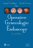 Operative Gynecologic Endoscopy - Masterson, B.J. (Foreword by), and Sanfilippo, Joseph S. (Editor), and Levine, Roland L. (Editor)