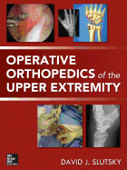 Operative Orthopedics of the Upper Extremity