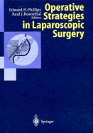 Operative Strategies in Laparoscopic Surgery