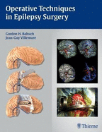Operative Techniques in Epilepsy Surgery