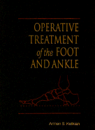Operative Treatment of the Foot and Ankle