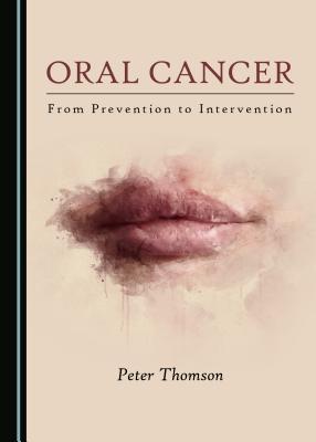Oral Cancer: From Prevention to Intervention - Thomson, Peter