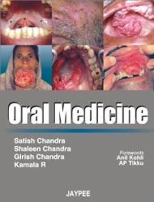 Oral Medicine - Chandra, Satish, and Chandra, Shaleen, and Chandra, Girish