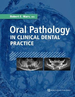 Oral Pathology in Clinical Dental Practice - Marx, Robert E