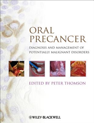 Oral Precancer: Diagnosis and Management of Potentially Malignant Disorders - Thomson, Peter (Editor)