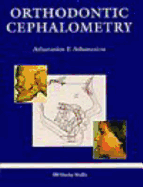Orthodontic Cephalometry - Athanasiou, A E