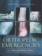 Orthopedic Emergencies: A Radiographic Altas
