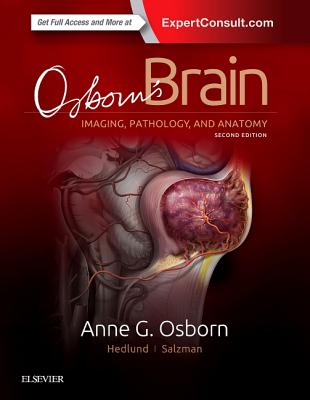 Osborn's Brain - Osborn, Anne G, MD, Facr, and Hedlund, Gary L, Do, and Salzman, Karen L, MD