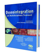 Osseointegration and Multidisciplinary Treament