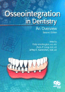 Osseointegration in Dentistry: An Overview - Worthington, Philip, and Lang, Brien R, and Rubenstein, Jeffrey E