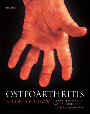 Osteoarthritis - Brandt, Kenneth D (Editor), and Doherty, Michael (Editor), and Lohmander, L Stefan (Editor)