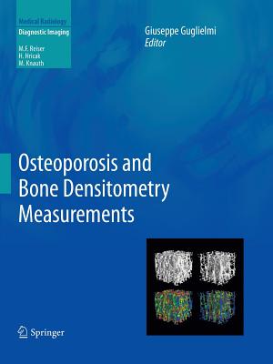 Osteoporosis and Bone Densitometry Measurements - Guglielmi, Giuseppe (Editor)