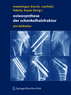 Osteosynthese der schenkelhalsfraktur: ein bildatlas