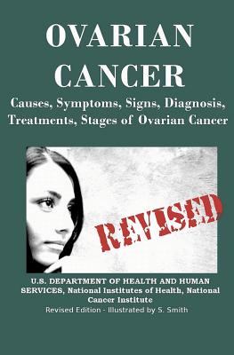 Ovarian Cancer: Causes, Symptoms, Signs, Diagnosis, Treatments, Stages of Ovarian Cancer - Institutes of Health, National, and Cancer Institute, National