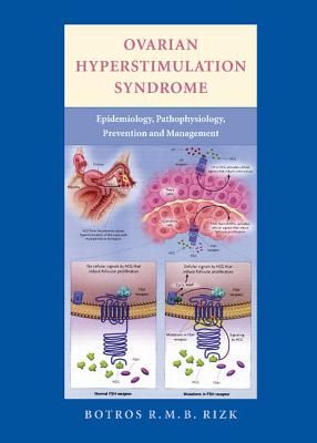 Ovarian Hyperstimulation Syndrome: Epidemiology, Pathophysiology, Prevention and Management - Rizk, Botros